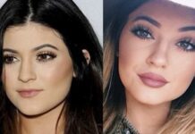 Get Lips Like Kylie Jenner Without the Surgery!