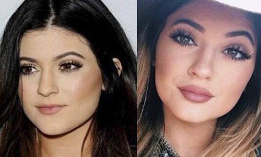 Get Lips Like Kylie Jenner Without the Surgery!