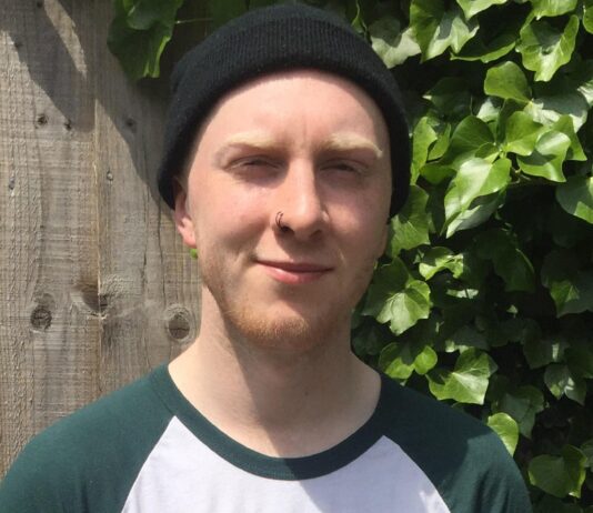 Who Is The Guy Plastering Brighton’s Pubs With His Teeth Illustrations? Meet Sam ‘Molar’ John!