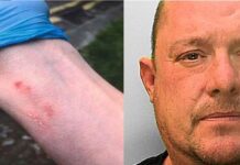 Hove Man Bites Officer After Harassing Police With Nuisance Calls