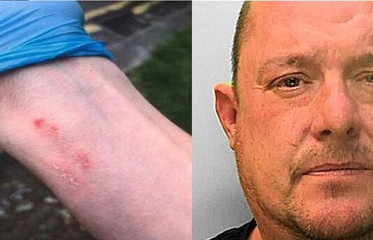 Hove Man Bites Officer After Harassing Police With Nuisance Calls