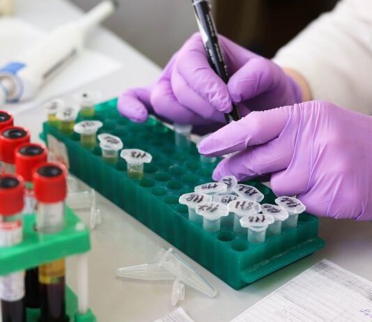 Brighton Professor Discovers New Doping Test