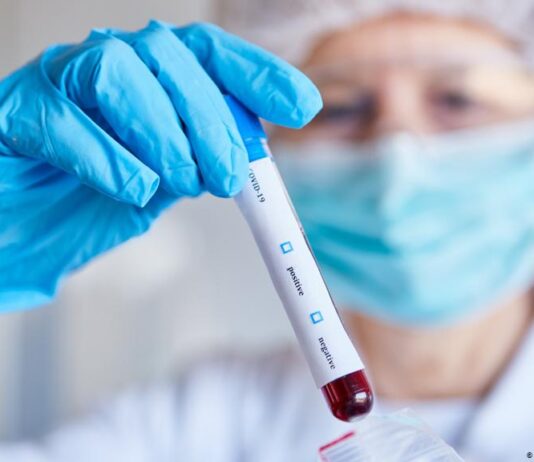 Lateral Flow Tests vs. PCR: Pros and Cons in Disease Diagnosis