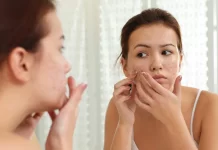 Treating Acne Scars: Discover Clear and Radiant Skin