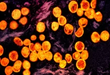 Weekend Culture -WHO has declared mpox a global health emergency