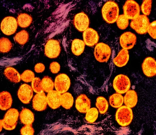Weekend Culture -WHO has declared mpox a global health emergency