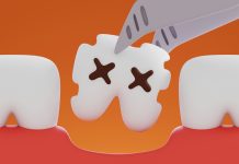 Key Features That Make a Dental Website Highly Effective
